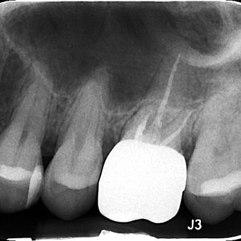New Day Dentistry Northglenn | Dr. Jamie Suman, DDS - General Dentistry Near Me - Northglenn, Colorado New Day Dentistry Northglenn | Dr. Jamie Suman, DDS - General Dentistry Near Me - Northglenn, Colorado