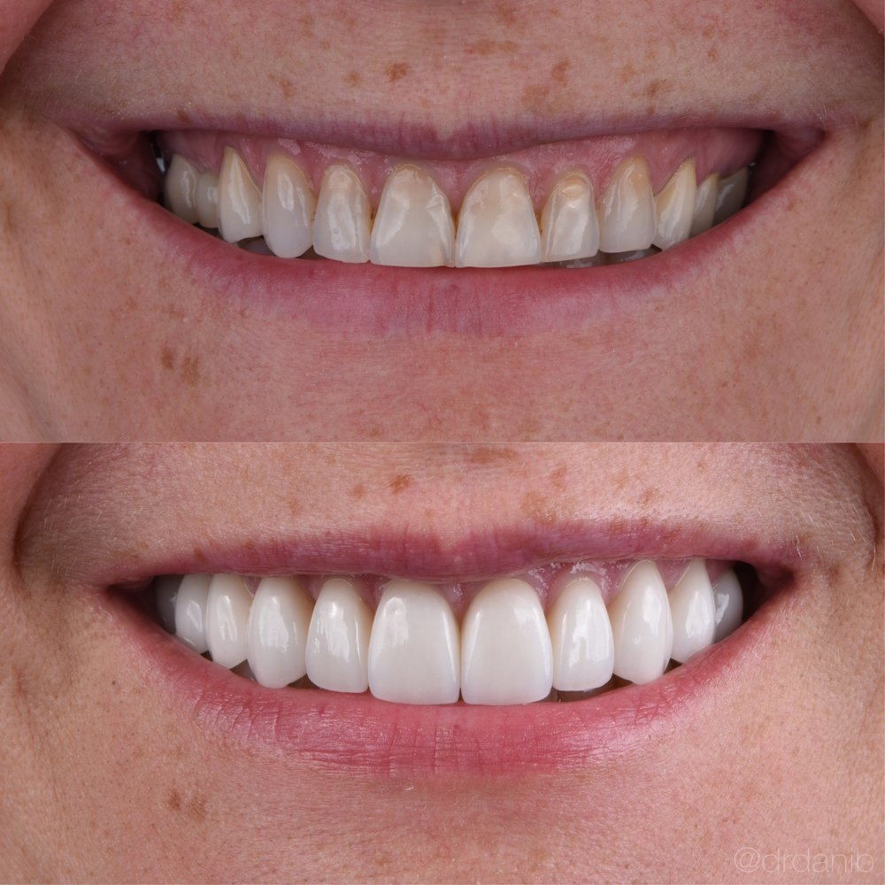 LEONID FUKS, DDS Updated September 2024 4424 Fort Hamilton Pkwy