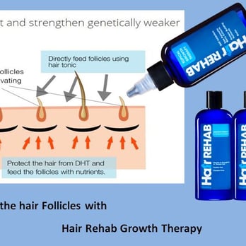 Hair Trauma Center - Reactivate follicles with Natural and FDA Approved DHT Blockers - Hair Loss Centers Near Me Hair Trauma Center - Reactivate follicles with Natural and FDA Approved DHT Blockers - Hair Loss Centers Near Me