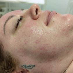 Serene Sage Spa - Dermaplaning