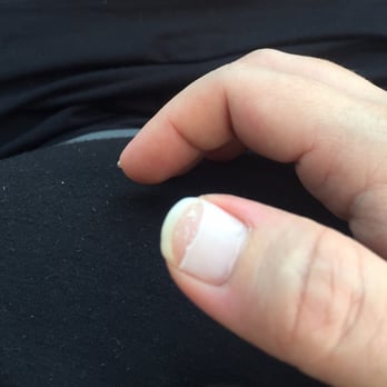 Eagle Nails and Spa - Here is one of my nails that is peeling. - Nail Salons Near Me - Havertown, Pennsylvania