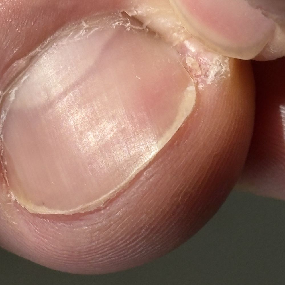 Park Place Nail Spa - Nails cut incorrectly - Nail Salons Near Me - Fort Worth, Texas Park Place Nail Spa - Nails cut incorrectly - Nail Salons Near Me - Fort Worth, Texas