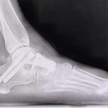1. Texas Foot and Ankle Consultants