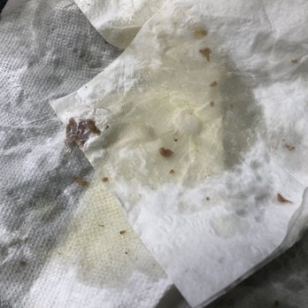 The Works Grill - 3 paper towels to soak up the 5w30 oil Onions that were rotted I wish you could smell - Greek Near Me - Glenview, Illinois The Works Grill - 3 paper towels to soak up the 5w30 oil Onions that were rotted I wish you could smell - Greek Near Me - Glenview, Illinois