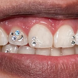 Ice My Pearls Tooth Gems