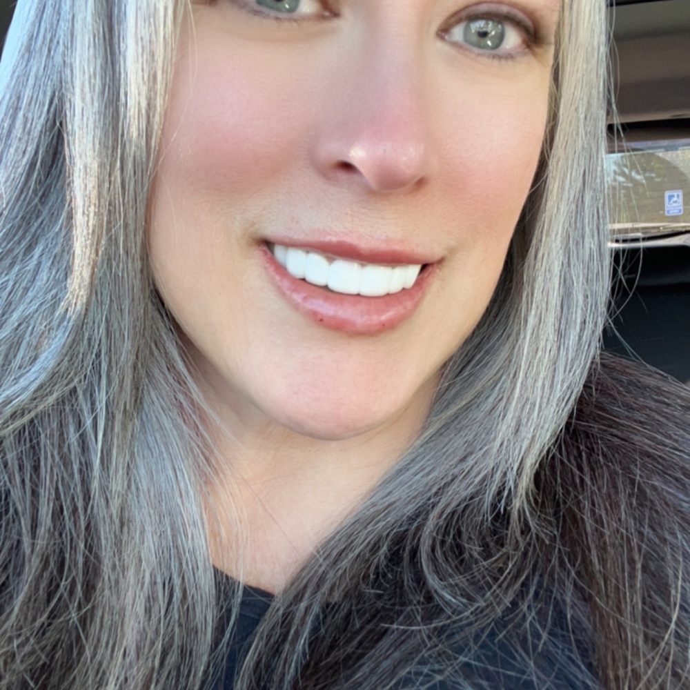 The Aesthetic - After first injection appointment with full smile. - Skin Care Near Me - Canton, Michigan