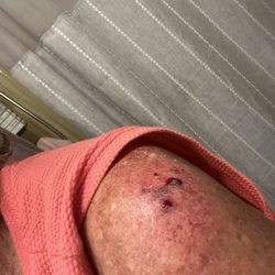 Advocare Haddonfield Pediatric Association - It's a picture of my shoulder