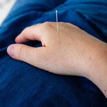 Twelve Pathways Acupuncture - Acupuncture Near Me - lisle, Illinois