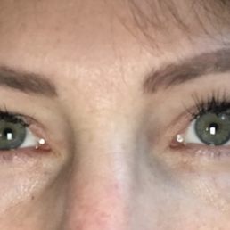 Healing eyebrows. Lashes.