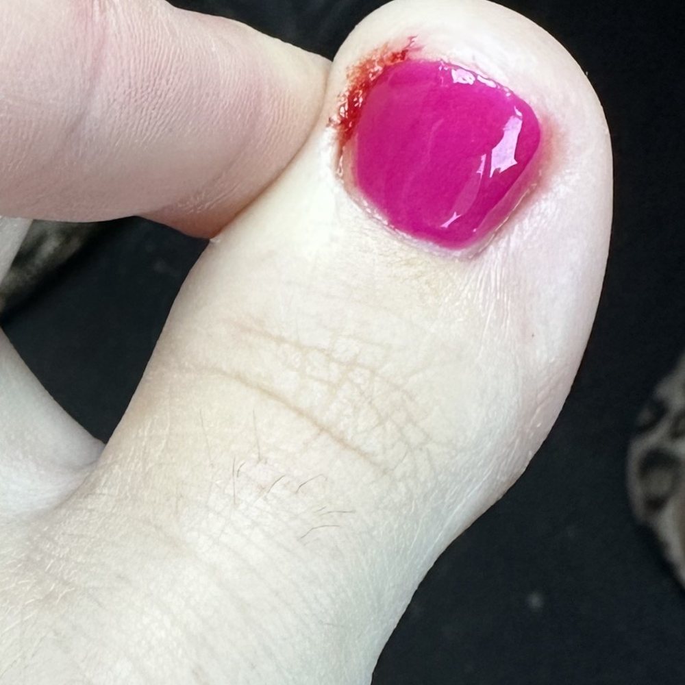 I have never had someone dig into a nail that is not ingrown and make me bleed! Do NOT go here!! I have never had someone dig into a nail that is not ingrown and make me bleed! Do NOT go here!!