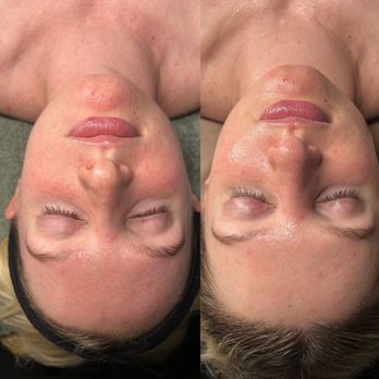 NuGlo Aesthetics - Skin Care Near Me - San Diego, California NuGlo Aesthetics - Skin Care Near Me - San Diego, California