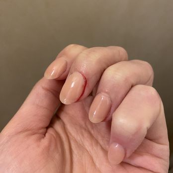 Nice Nails Spa - Bleeding cuticles and broke through skin. - Nail Salons Near Me - San Carlos, California Nice Nails Spa - Bleeding cuticles and broke through skin. - Nail Salons Near Me - San Carlos, California
