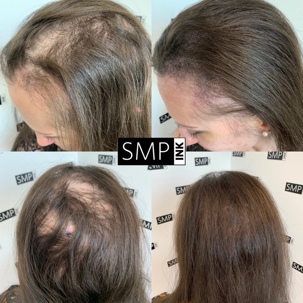 SMP INK - Before and after - Hair Loss Centers Near Me - Las Vegas, Nevada SMP INK - Before and after - Hair Loss Centers Near Me - Las Vegas, Nevada