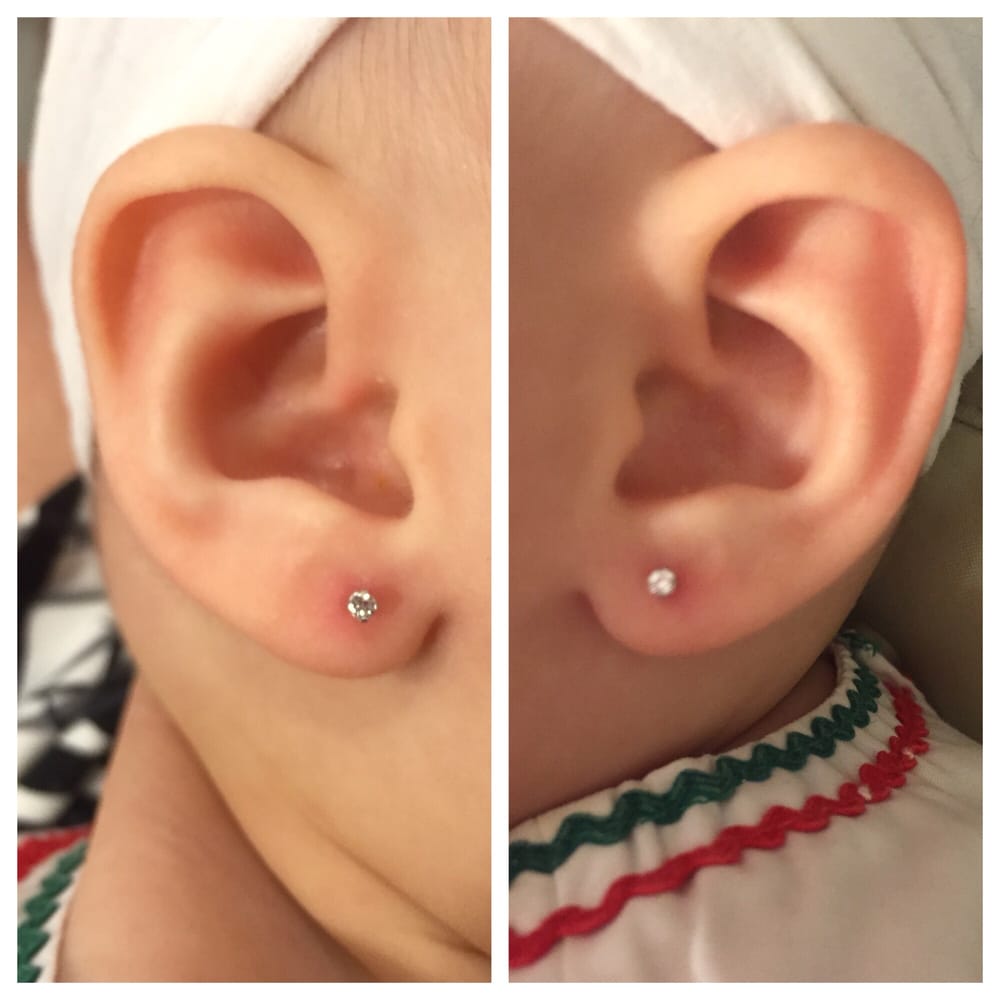 baby earring infected