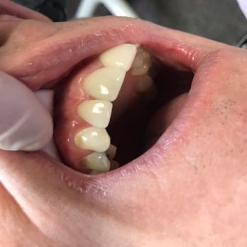 Destefanis Paul M DDS - Oral Surgeons Near Me - Elm Grove, Wisconsin Destefanis Paul M DDS - Oral Surgeons Near Me - Elm Grove, Wisconsin