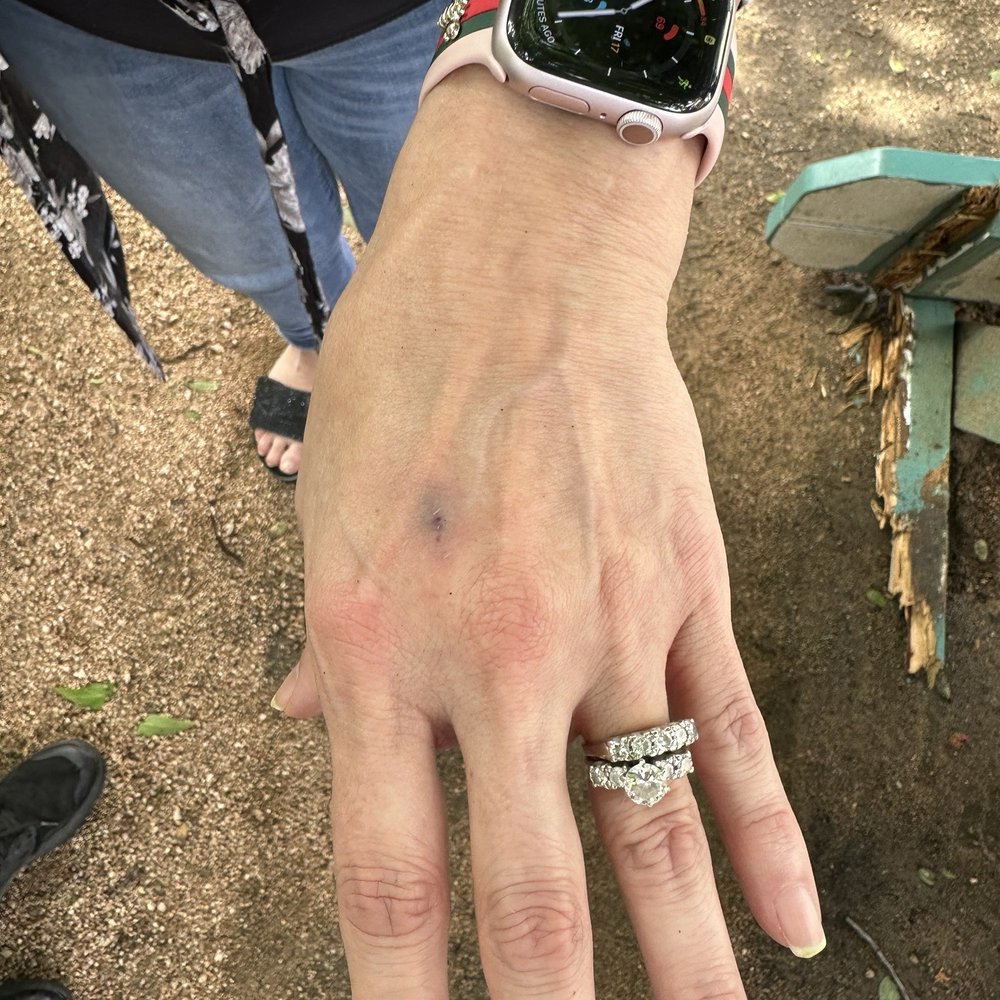 Sweet Lemon Kitchen - Injury at Sweet Lemon Kitchen - Cafes Near Me - Georgetown, Texas Sweet Lemon Kitchen - Injury at Sweet Lemon Kitchen - Cafes Near Me - Georgetown, Texas
