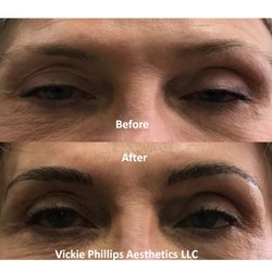 Vickie Phillips Aesthetics - We created fullness with her brows, enhancing her appearance.