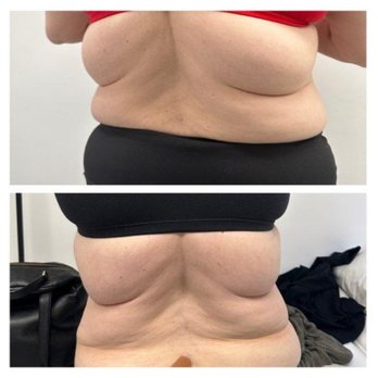 Haute Healing Oasis - OMG- look at this! after a little over a month! - Saunas Near Me - Stamford, Connecticut Haute Healing Oasis - OMG- look at this! after a little over a month! - Saunas Near Me - Stamford, Connecticut