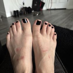 Milano Nail Spa Walnut Creek - Scrapes on my feet from how rough the tech was & the device he used