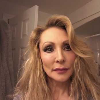 Eye Face Institute - I use to look like this... - Plastic Surgeons Near Me - Toronto, Ontario Eye Face Institute - I use to look like this... - Plastic Surgeons Near Me - Toronto, Ontario