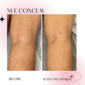 Heal Ink Beauty - Permanent Makeup Near Me Heal Ink Beauty - Permanent Makeup Near Me