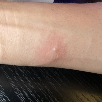 The LKSD - Watch out for hot plates ! - Burgers Near Me - Downey, California The LKSD - Watch out for hot plates ! - Burgers Near Me - Downey, California