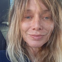 3 months after my procedure