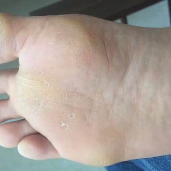 HighPark Nail Spa - There was no grating done on my feet which was especially frustrating because you can see how they are callused and peeling. - Nail Salons Near Me - Raleigh, North Carolina