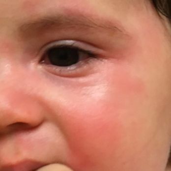 Denise's Daycare - This photo was taken two hours after being abused and neglected by Denise. - Child Care & Day Care Near Me - Palm Desert, California Denise's Daycare - This photo was taken two hours after being abused and neglected by Denise. - Child Care & Day Care Near Me - Palm Desert, California