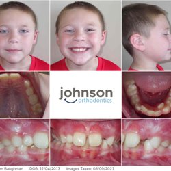 Johnson Orthodontics