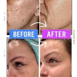 Luminous Glow Skin and Laser