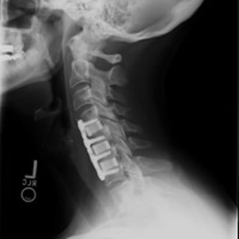 Brian Grossman, MD - Ouch but lifesaving! - Orthopedists Near Me - Thousand Oaks, California Brian Grossman, MD - Ouch but lifesaving! - Orthopedists Near Me - Thousand Oaks, California
