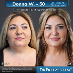 Dr Freeze CoolSculpting Center