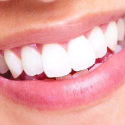 Serenity Dental Center - OC - Smile whitening is available -chairside by the doctor full session including Booster take home trays: Only $465 (Limited Time)