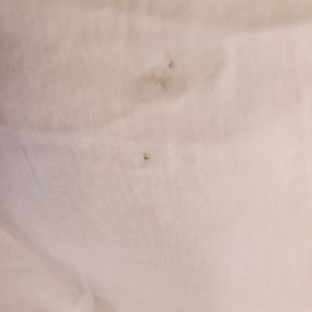Whitney Peak Hotel Reno, Tapestry Collection by Hilton - Pillow case! Absolutely disgusting. - Hotels Near Me - Reno, Nevada Whitney Peak Hotel Reno, Tapestry Collection by Hilton - Pillow case! Absolutely disgusting. - Hotels Near Me - Reno, Nevada