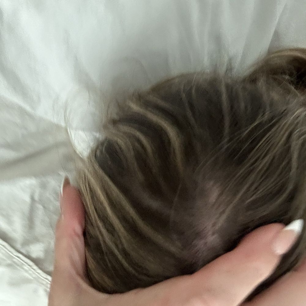 Metropolis Salon - Smudge root with a side of bald spot - Hair Salons Near Me - Columbia, South Carolina Metropolis Salon - Smudge root with a side of bald spot - Hair Salons Near Me - Columbia, South Carolina