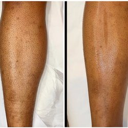 Brooke Marie Aesthetics - Leg waxing