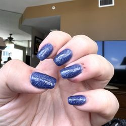 Casa Beauty - More cuts and abrasions, this one being the worst one.