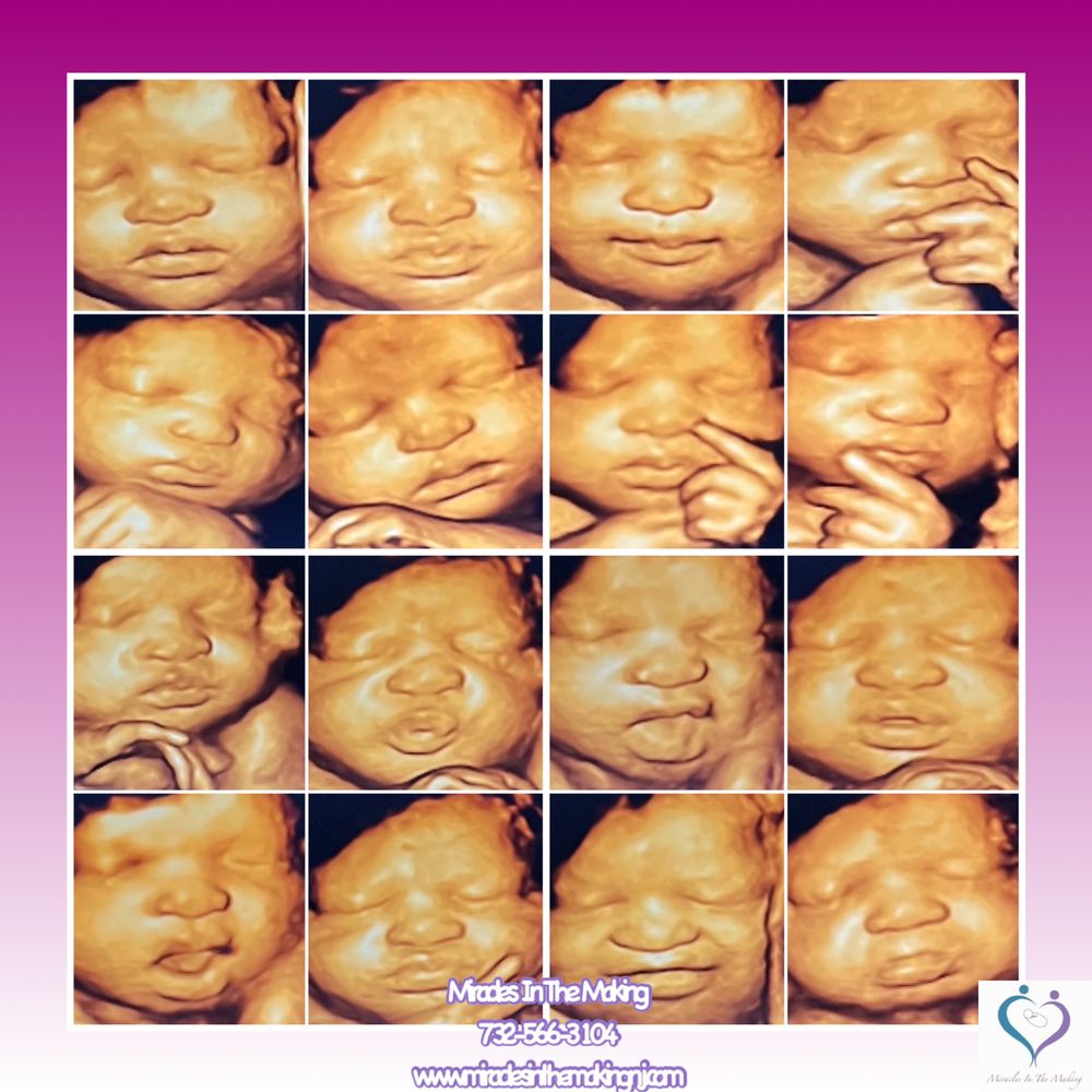 3d Ultrasound Union Nj edu.svet.gob.gt