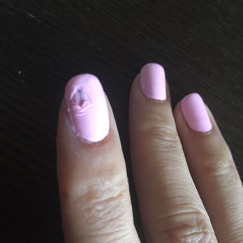 Nail Essence Salon & Spa - This is what happened to my finger when they kicked me out after finishing the polish right away! - Nail Salons Near Me - Morton Grove, Illinois Nail Essence Salon & Spa - This is what happened to my finger when they kicked me out after finishing the polish right away! - Nail Salons Near Me - Morton Grove, Illinois