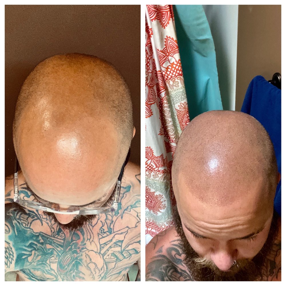 TOP SCALP MICRO 101 E Allen St, Hendersonville, North Carolina Hair