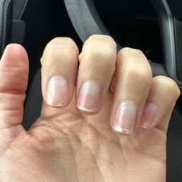 Severely filed down nails Severely filed down nails