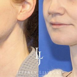 Jeffrey Lisiecki,MD
