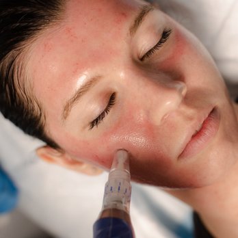VIO Med Spa - Medical Spas Near Me - Redmond, Washington