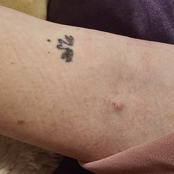BioLife Plasma Services - Needle site