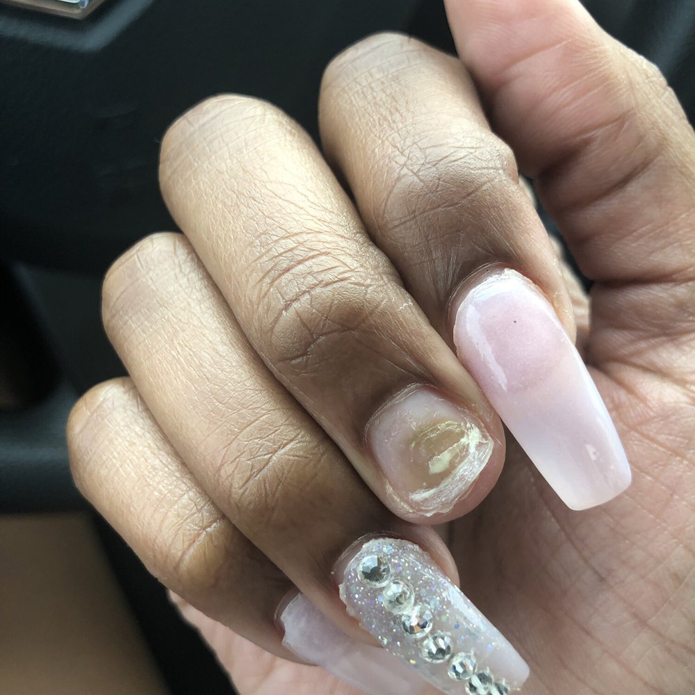 Grand Nail Bar - Fungus left on my nail after a week of having them. - Nail Salons Near Me - DeSoto, Texas Grand Nail Bar - Fungus left on my nail after a week of having them. - Nail Salons Near Me - DeSoto, Texas