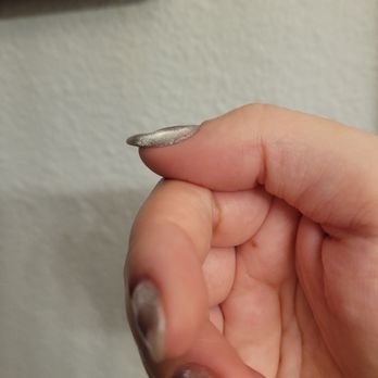 Nail Spot - All but my pinky nail are this dented. There is a massive divot in each nail. - Nail Salons Near Me - San Diego, California Nail Spot - All but my pinky nail are this dented. There is a massive divot in each nail. - Nail Salons Near Me - San Diego, California