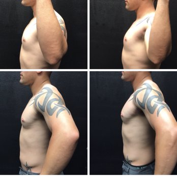 Sol Plex Performance - Massage Therapy Near Me - Orange, California