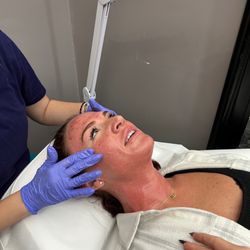 Bellissima Medical Spa - Morpheous8 treatment