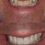 Galindo Prosthodontics